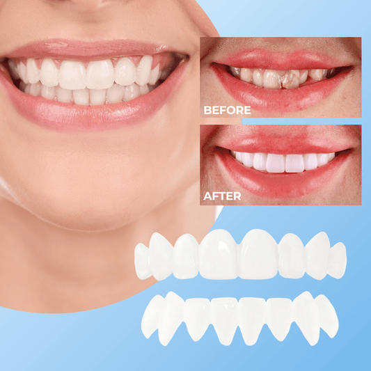 BrightSmile™ - Clip-On Teeth-Veneers